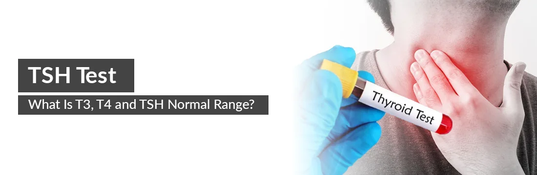  TSH Test: What Is T3, T4 and TSH Normal Range?